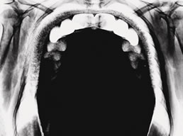 Decifra-me ou devoro-te