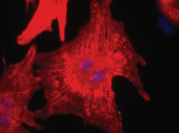 Interprete de imagens